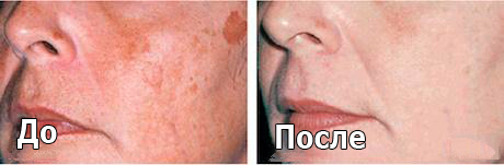 melslom_tiffimedspa
