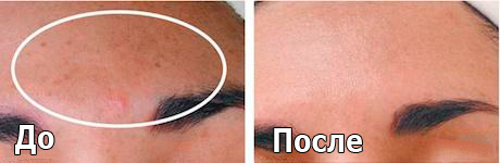 melslom_tiffimedspa