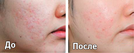 melslom_tiffimedspa