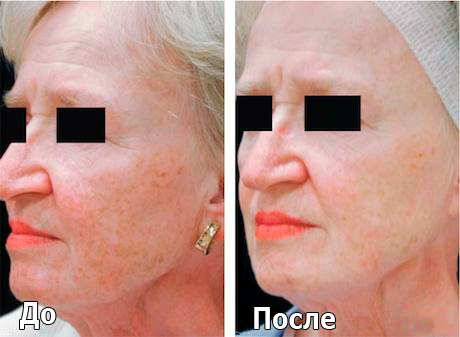 melslom_tiffimedspa