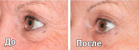 melslom_tiffimedspa