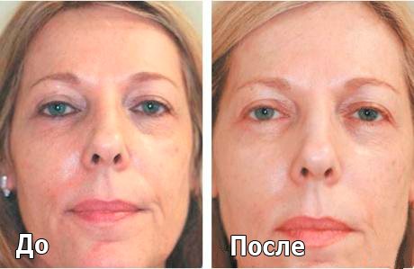 melslom_tiffimedspa